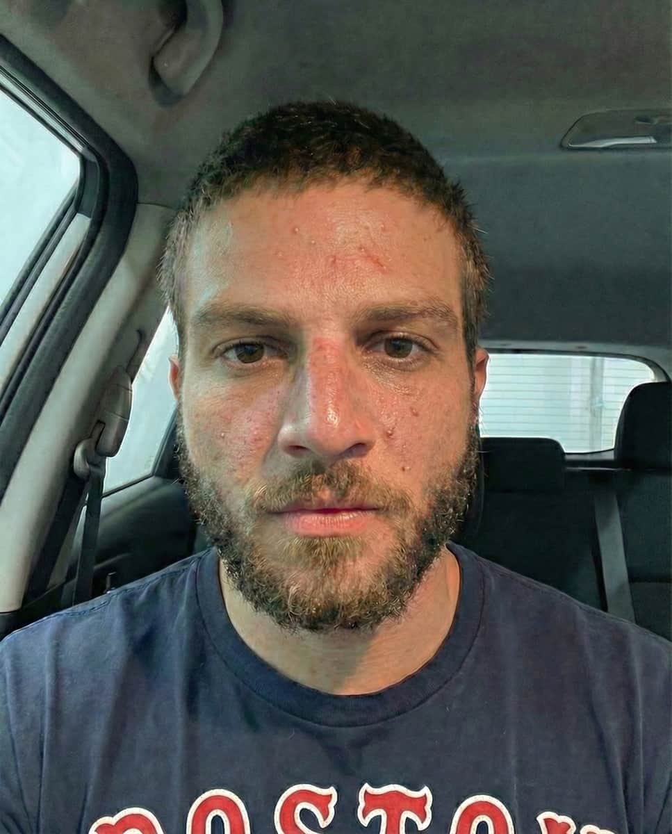 Face analysis with golden ratio